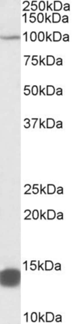 Invitrogen TRIM71 Polyclonal Antibody 100 &mu;g; Unconjugated:Antibodies,