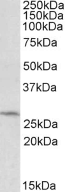 Invitrogen DCUN1D1 Polyclonal Antibody 100 &mu;g; Unconjugated:Antibodies,