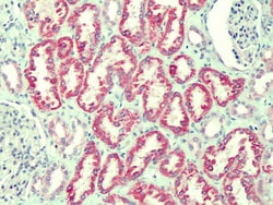 Invitrogen CMG2 Polyclonal Antibody 100 &mu;g; Unconjugated:Antibodies,