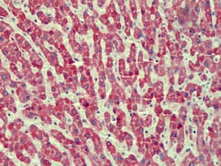 Invitrogen CMG2 Polyclonal Antibody 100 &mu;g; Unconjugated:Antibodies,