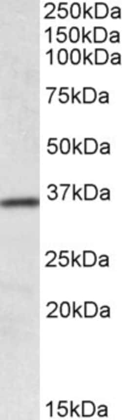 Invitrogen HOXA4 Polyclonal Antibody 100 &mu;g | Buy Online | Invitrogen&trade; | Fisher Scientific