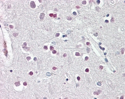 Invitrogen SOX3 Polyclonal Antibody 100 μg; Unconjugated:Antibodies,