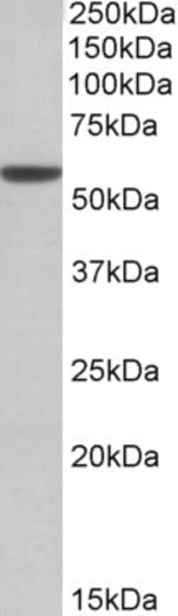 Invitrogen ALDH3A1 Polyclonal Antibody 100 &mu;g; Unconjugated:Antibodies,
