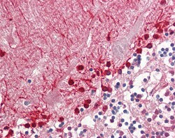 Invitrogen ALDH9A1 Polyclonal Antibody 100 &mu;g; Unconjugated:Antibodies,