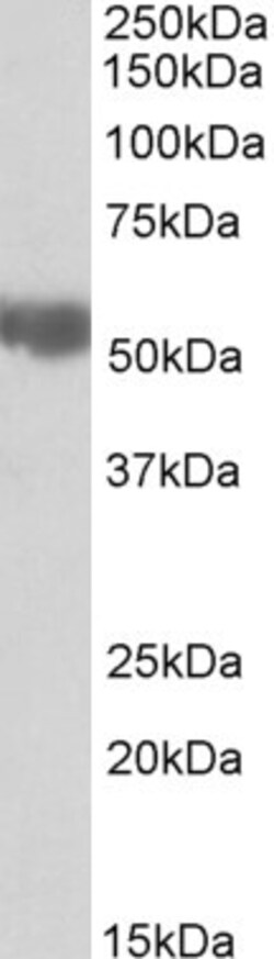 Invitrogen ALDH3A2 Polyclonal Antibody 100 &mu;g; Unconjugated:Antibodies,