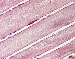 Invitrogen GLUT4 Polyclonal Antibody 100 &mu;g; Unconjugated:Antibodies,