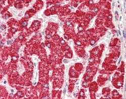 Invitrogen ETFB Polyclonal Antibody 100 &mu;g; Unconjugated:Antibodies,