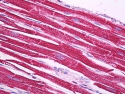 Invitrogen NDUFS1 Polyclonal Antibody 100 &mu;g; Unconjugated:Anticuerpos