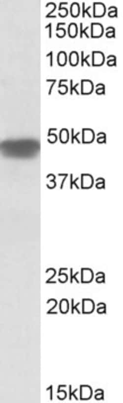 Invitrogen NDUFS2 Polyclonal Antibody 100 &mu;g; Unconjugated:Antibodies,