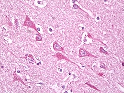 Invitrogen NDUFS7 Polyclonal Antibody 100 &mu;g; Unconjugated:Antibodies,