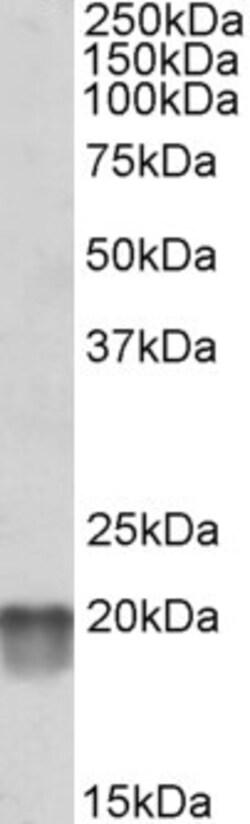 Invitrogen NDUFS7 Polyclonal Antibody 100 &mu;g; Unconjugated:Antibodies,