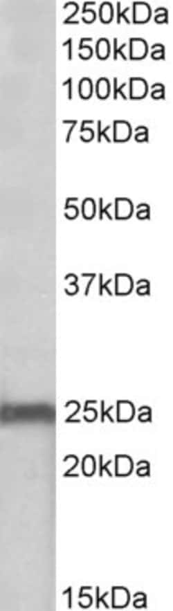 Invitrogen NDUFS8 Polyclonal Antibody 100 μg; Unconjugated:Antibodies,