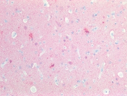 Invitrogen PGP9.5 Polyclonal Antibody 100 &mu;g; Unconjugated:Antibodies,