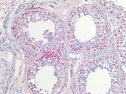 Invitrogen PGP9.5 Polyclonal Antibody 100 &mu;g; Unconjugated:Antibodies,