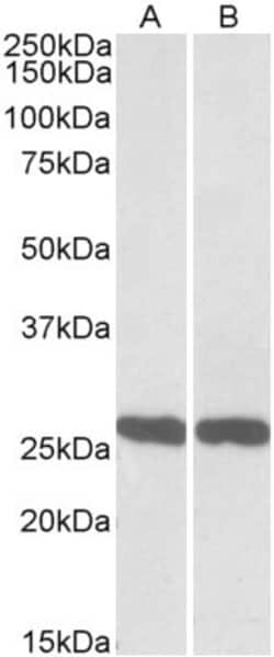 Invitrogen PGP9.5 Polyclonal Antibody 100 &mu;g; Unconjugated:Antibodies,