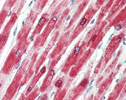Invitrogen Phospholamban Polyclonal Antibody 100 &mu;g; Unconjugated:Antibodies,