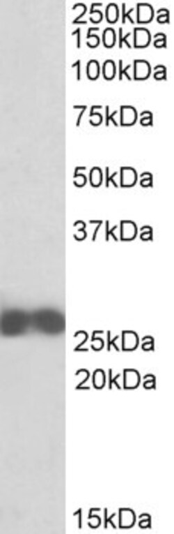 Invitrogen D4-GDI Polyclonal Antibody 100 &mu;g | Buy Online | Invitrogen&trade; | Fisher Scientific