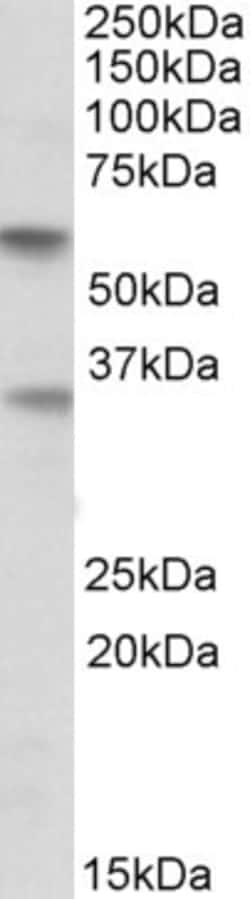 Invitrogen SIGLEC6 Polyclonal Antibody 100 &mu;g; Unconjugated:Antibodies,