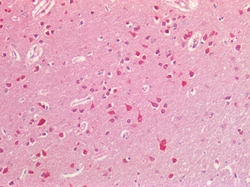 Invitrogen Ephrin B2 Polyclonal Antibody 100 &mu;g; Unconjugated:Anticuerpos