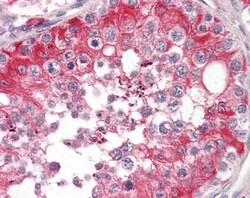 Invitrogen Ephrin B2 Polyclonal Antibody 100 &mu;g; Unconjugated:Anticuerpos