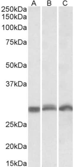 Invitrogen PSMA4 Polyclonal Antibody 100 &mu;g; Unconjugated:Antibodies,