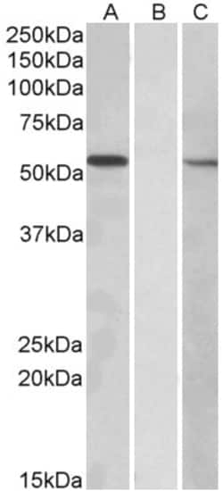Invitrogen MGAT1 Polyclonal Antibody 100 &mu;g; Unconjugated:Antibodies,