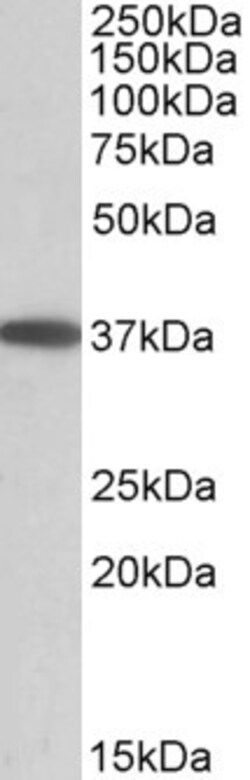 Invitrogen MOGAT2 Polyclonal Antibody 100 &mu;g; Unconjugated:Antibodies,