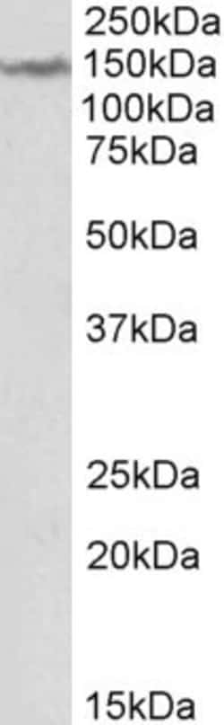 Invitrogen LMTK2 Polyclonal Antibody 100 μg; Unconjugated:Antibodies,