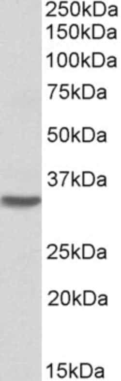 Invitrogen HOXC8 Polyclonal Antibody 100 &mu;g; Unconjugated:Antibodies,