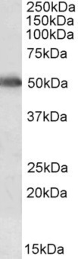 Invitrogen CYP2E1 Polyclonal Antibody 100 μg; Unconjugated:Antibodies,