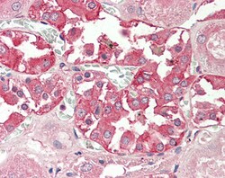 Invitrogen RHCG Polyclonal Antibody 100 &mu;g; Unconjugated:Antibodies,