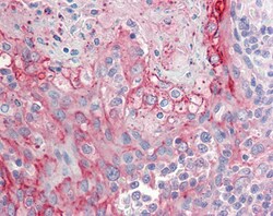Invitrogen RHCG Polyclonal Antibody 100 &mu;g; Unconjugated:Antibodies,