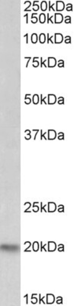 Invitrogen PSMB9 Polyclonal Antibody 100 &mu;g | Buy Online | Invitrogen&trade; | Fisher Scientific