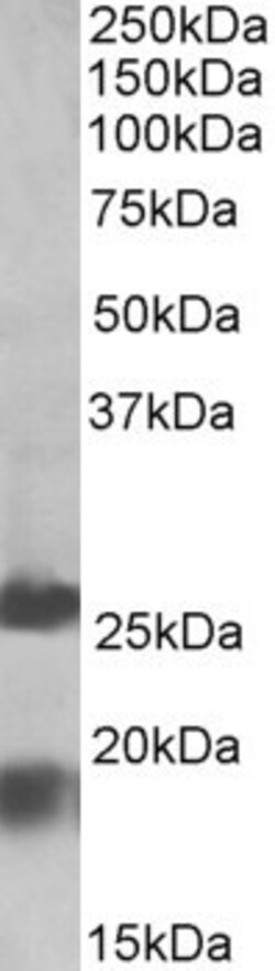 Invitrogen MPV17 Polyclonal Antibody 100 &mu;g; Unconjugated:Antibodies,