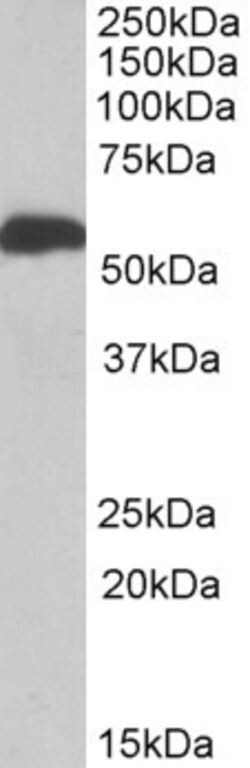 Invitrogen ALDH5A1 Polyclonal Antibody 100 &mu;g; Unconjugated:Antibodies,