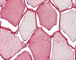 Invitrogen TRIM72 Polyclonal Antibody 100 &mu;g; Unconjugated:Antibodies,