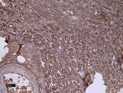 Invitrogen Dynactin 3 Polyclonal Antibody 100 μg; Unconjugated:Antibodies,