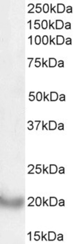 Invitrogen Dynactin 3 Polyclonal Antibody 100 μg; Unconjugated:Antibodies,