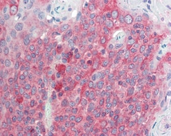 Invitrogen TMEM205 Polyclonal Antibody 100 &mu;g; Unconjugated:Antibodies,