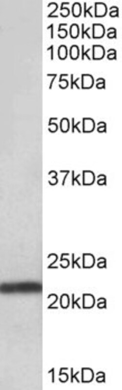 Invitrogen TMEM205 Polyclonal Antibody 100 &mu;g; Unconjugated:Antibodies,
