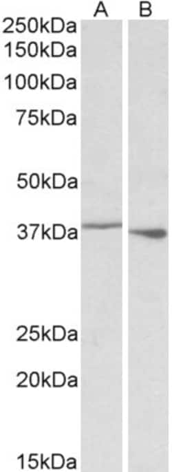 Invitrogen PCBP1 Polyclonal Antibody 100 &mu;g; Unconjugated:Antibodies,