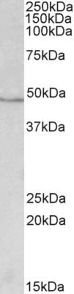 Invitrogen IDH1 Polyclonal Antibody 100 &mu;g; Unconjugated:Antibodies,