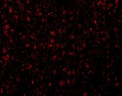 Invitrogen CCR3 Polyclonal Antibody 100 &mu;g; Unconjugated:Antibodies,