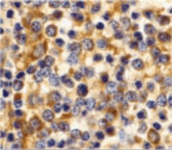 Invitrogen CCR3 Polyclonal Antibody 100 &mu;g; Unconjugated:Antibodies,