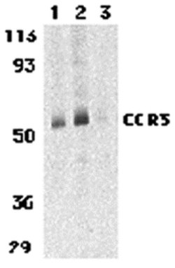 Invitrogen CCR3 Polyclonal Antibody 100 &mu;g; Unconjugated:Antibodies,