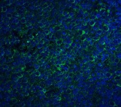 Invitrogen CCR5 Polyclonal Antibody 100 μg; Unconjugated:Antibodies,
