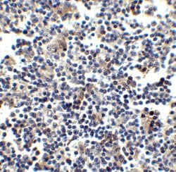 Invitrogen CCR5 Polyclonal Antibody 100 μg; Unconjugated:Antibodies,