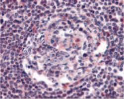 Invitrogen CCR5 Polyclonal Antibody 100 μg; Unconjugated:Antibodies,