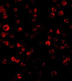 Invitrogen RAIDD Polyclonal Antibody 100 &mu;g | Buy Online | Invitrogen&trade; | Fisher Scientific