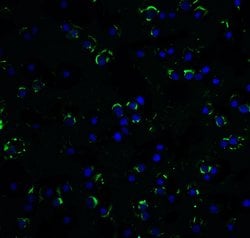 Invitrogen RAIDD Polyclonal Antibody 100 &mu;g | Buy Online | Invitrogen&trade; | Fisher Scientific